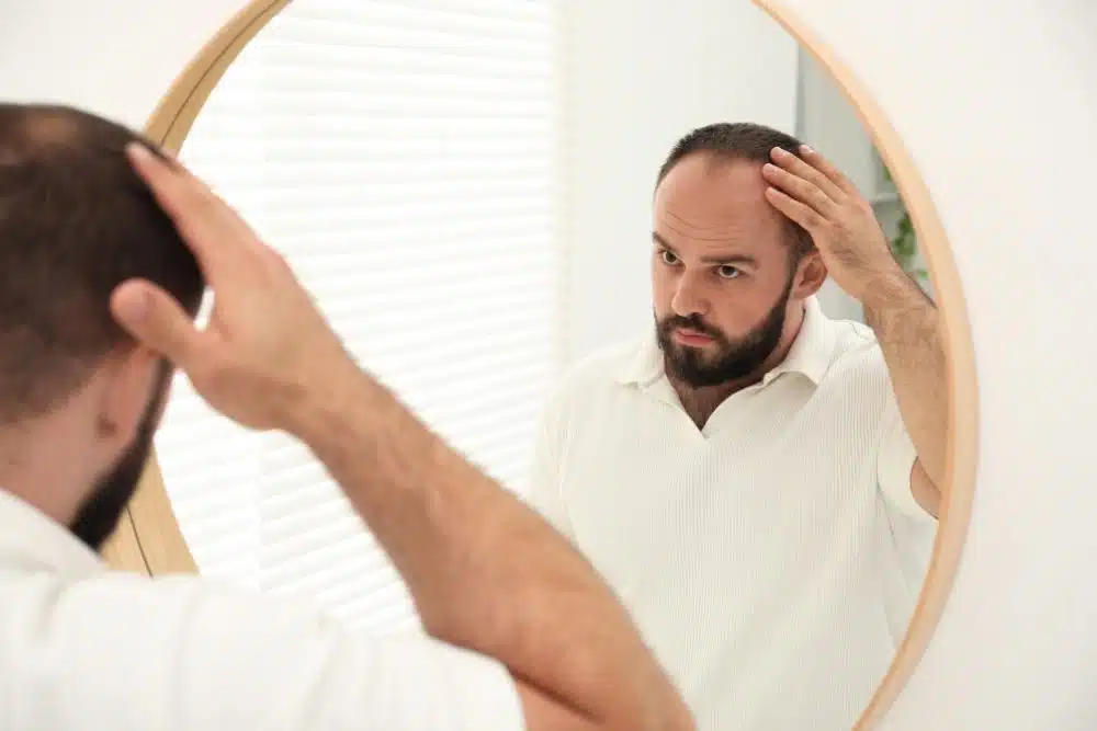 Not Ready for Hair Transplant Surgery? Why a Hair System Is a Smart First Step